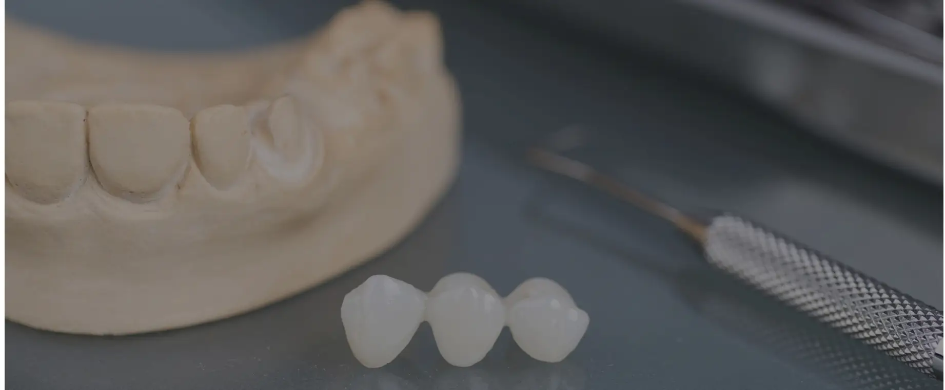 Dental Bridge Cronin Dental Cork